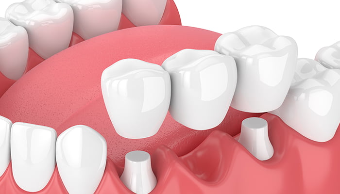 York dental