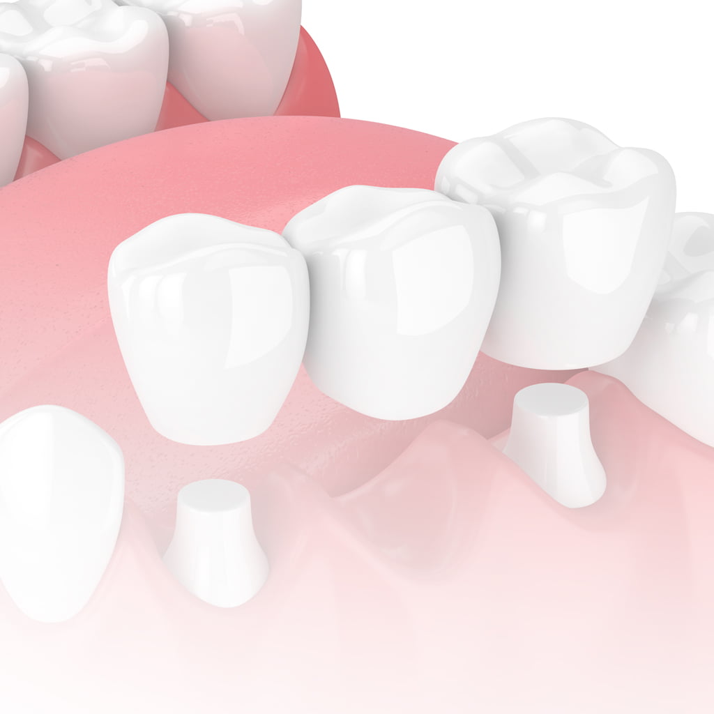 Treatment - York dental