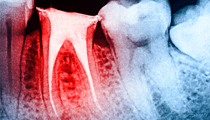 York dental