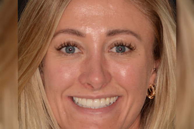 After - York Dental