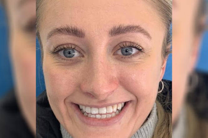 Before - York Dental