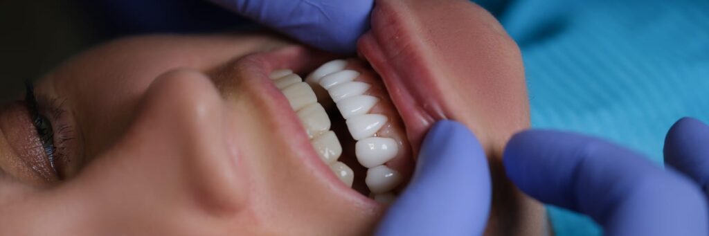 chipped tooth in York