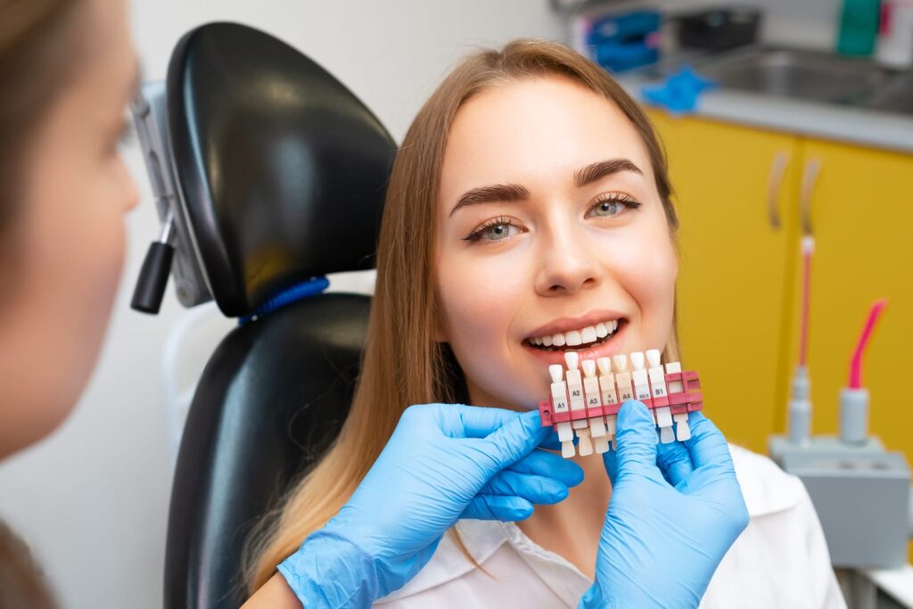 Dental veneers