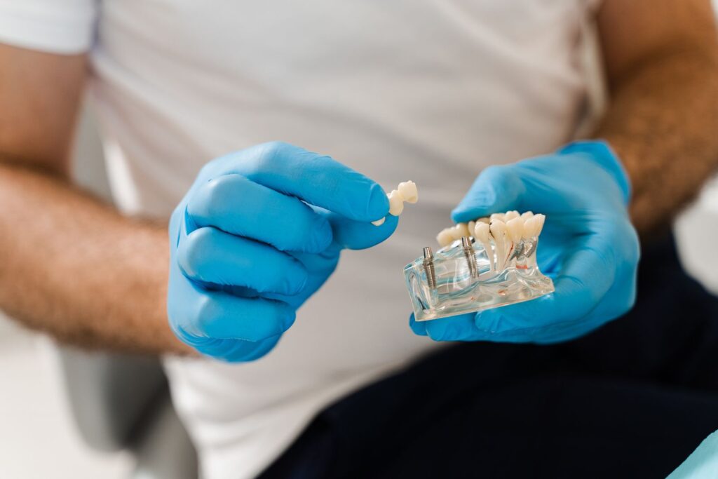 dental Implants for missing teeth