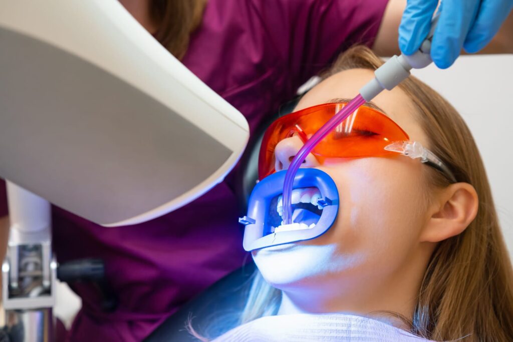 professional Teeth whitening in York