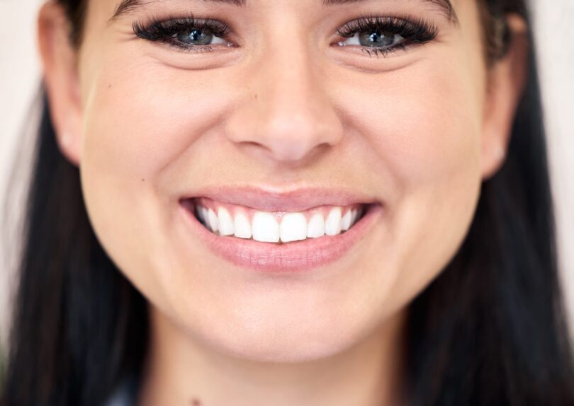 Invisalign in York