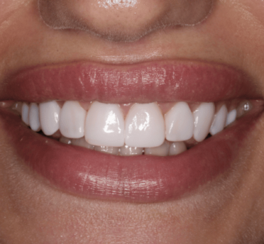 Smile Gallery