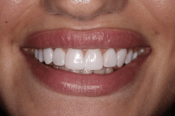 After - York Dental Suite