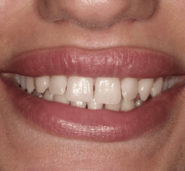 Smile Gallery