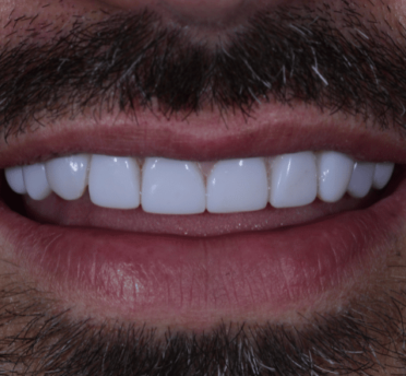 Smile Gallery