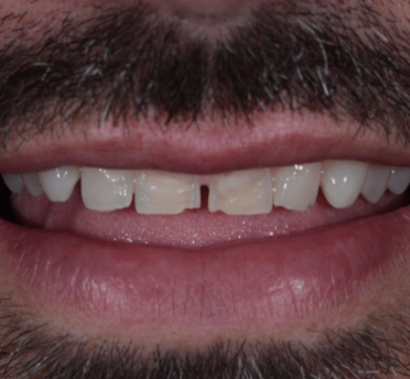 Smile Gallery