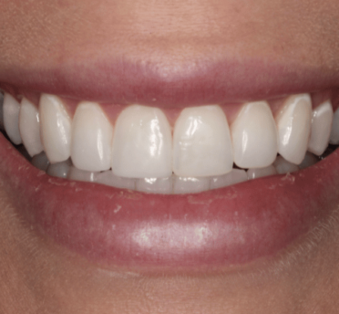 Smile Gallery