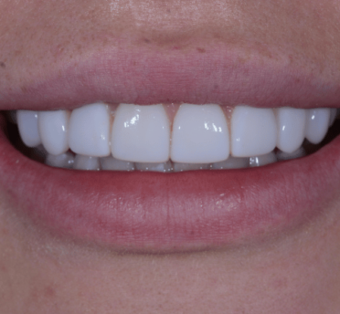 Smile Gallery