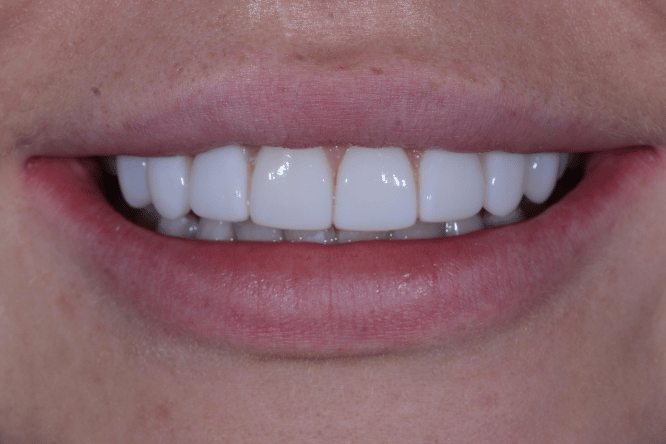 After - York Dental Suite