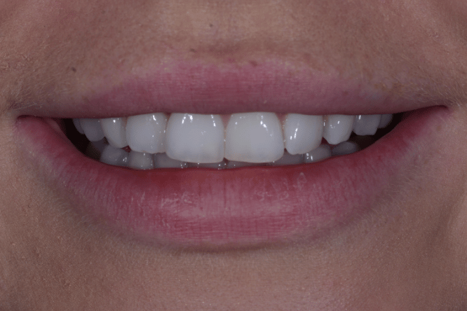 Before - York Dental Suite