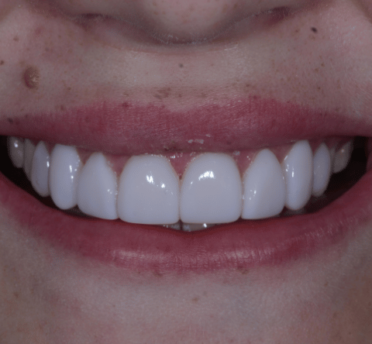 Smile Gallery