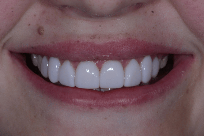 After - York Dental Suite