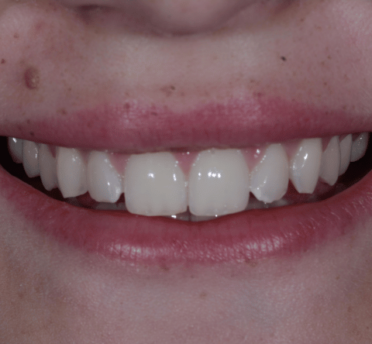 Smile Gallery
