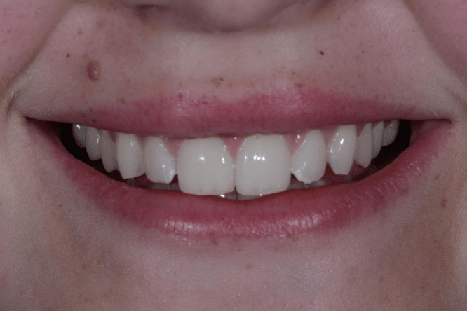 Before - York Dental