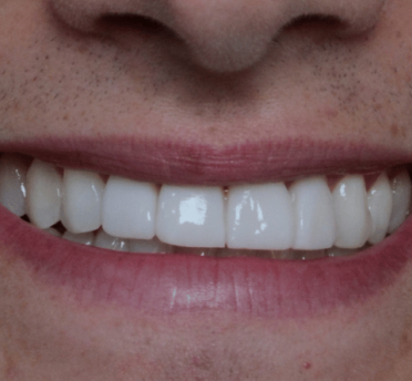 Smile Gallery