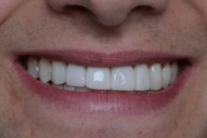 After - York Dental