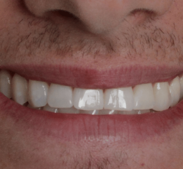 Smile Gallery