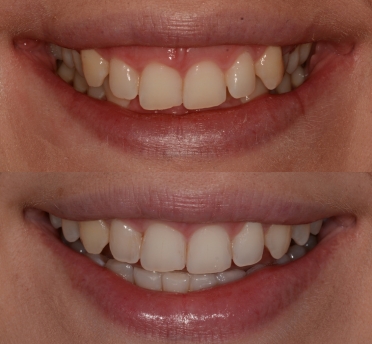 Smile Gallery