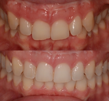 Smile Gallery