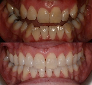 Smile Gallery