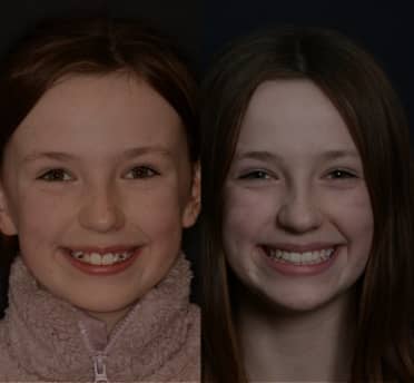 Smile Gallery