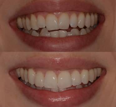 Smile Gallery