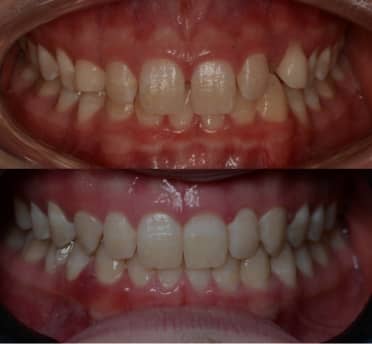 Smile Gallery