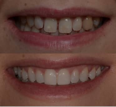 Smile Gallery