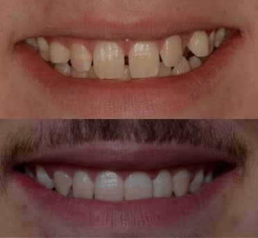 Smile Gallery