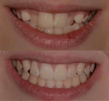 Smile Gallery