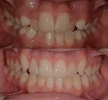 Smile Gallery